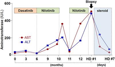 Nilotinib-Induced Immune-Mediated Liver Injury: Corticosteroid as a Possible Therapeutic Option